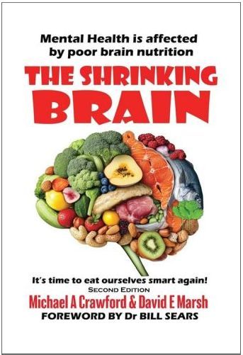 Book cover Shrinking Brain